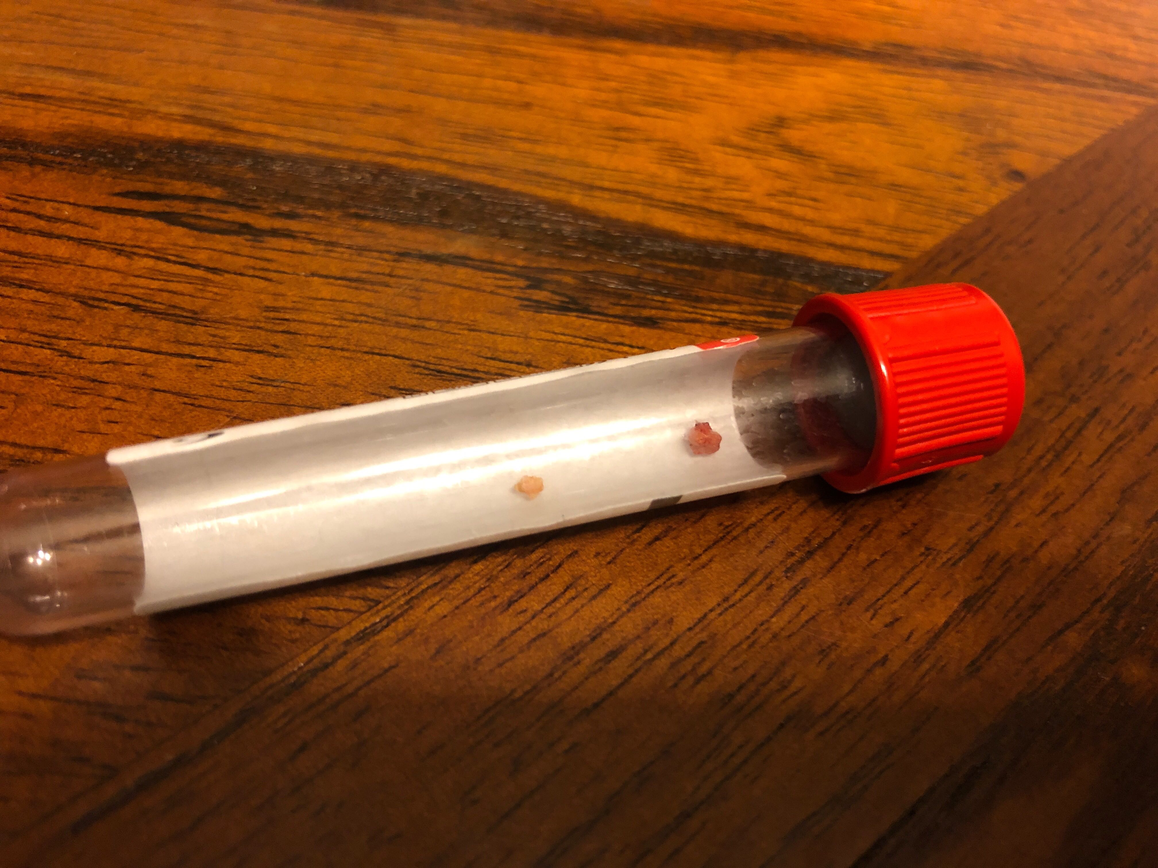 Dog Kidney Stones Come Wag Along