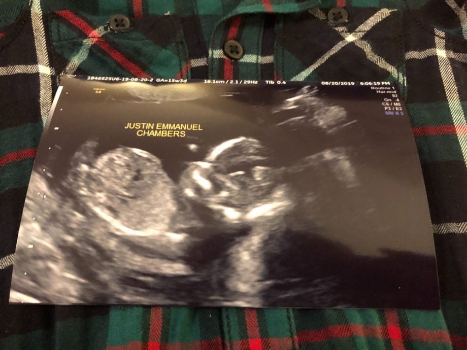 15 weeks boy ultrasound